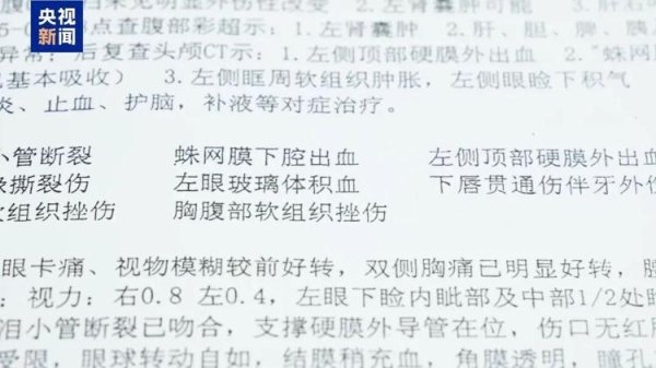 易启胜 好意让同事搭便车，却发生车祸致其受伤，车主要赔偿吗？